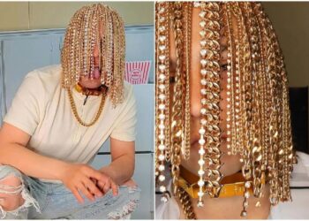 മുടിയില്ല, ശസ്ത്രക്രിയയിലൂടെ തലയില്‍ സ്വര്‍ണ്ണചെയിനുകള്‍ തുന്നിച്ചേര്‍ത്തു; വ്യത്യസ്തനായി മെക്‌സികന്‍ റാപ്പര്‍