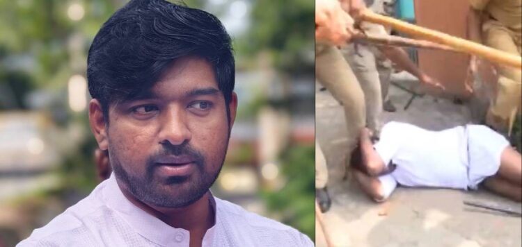 പൊലീസിൽ നിന്ന് കിട്ടിയഅടിയേക്കാൾ വേദന തോന്നുന്ന നീതിയില്ലാത്തതീരുമാനം;യൂത്ത്കോൺഗ്രസ് ആലപ്പുഴജില്ലാ പ്രസിഡന്‍റ്