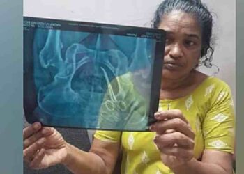 ചികിത്സാ പിഴവ്: സ്വമേധയാ കേസെടുത്ത് മനുഷ്യാവകാശ കമ്മീഷൻ, ഉഷയുടെ ശസ്ത്രക്രിയ നാളെ