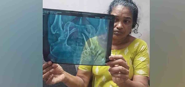 ചികിത്സാ പിഴവ്: സ്വമേധയാ കേസെടുത്ത് മനുഷ്യാവകാശ കമ്മീഷൻ, ഉഷയുടെ ശസ്ത്രക്രിയ നാളെ