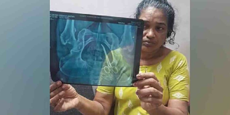 ചികിത്സാ പിഴവ്: സ്വമേധയാ കേസെടുത്ത് മനുഷ്യാവകാശ കമ്മീഷൻ, ഉഷയുടെ ശസ്ത്രക്രിയ നാളെ