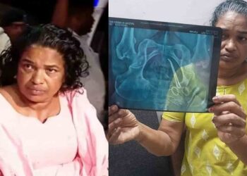 വയറ്റില്‍ കത്രിക കുടുങ്ങിയ വീട്ടമ്മയെ അമൃത ആശുപത്രിയില്‍ പ്രവേശിപ്പിച്ചു; ആവശ്യമെങ്കില്‍ ഉടന്‍ ശസ്ത്രക്രിയ